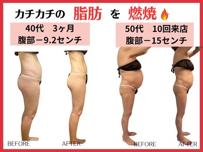 ルビー(RUBY)の写真