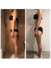 エイジングケアサロン 青山 本店/ビフォア・アフター！