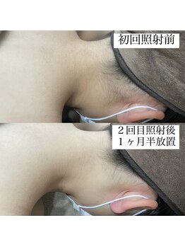 テンパ ビューティー(+10%beauty)/効果写真