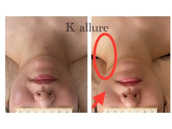 カリュール(K'allure)/首がながくなります