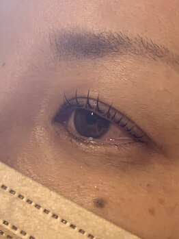 タルテ 太田(talute)/ダメージレスラッシュリフト