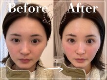 R-1ビューティーサロン 表参道/Before＆After