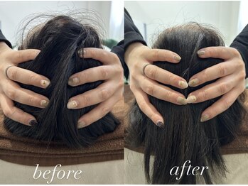 おひさま整骨院 整体院 姫路店/B＆A【姫路/小顔矯正/整体】