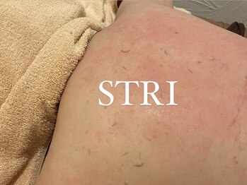 ストリ(STRI)/角質ってこんなに出るの？！