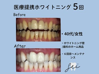 セイ(sei)/症例写真　ビフォーアフター