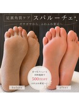 チック(chick)/スパルーチェ角質ケア｜素足美人