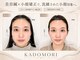 【美容鍼×小顔矯正】KADOMORI カドモリ 銀座の写真