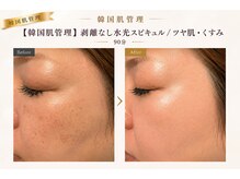 アオイスター(AOIstar)