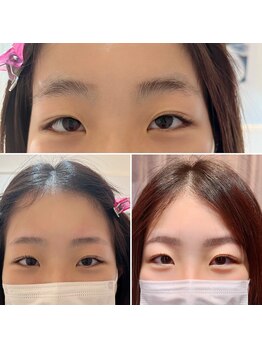 美眉アンド美肌専門サロンすみれ/ビフォーアフター