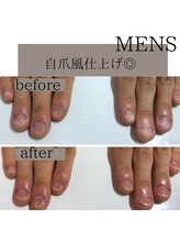 ティアラネイル(tiaranail)/再発させない深爪矯正
