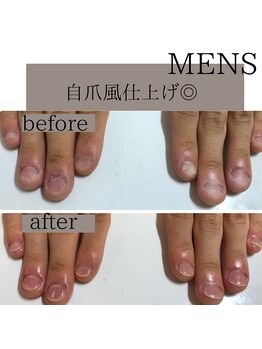 ティアラネイル(tiaranail)/再発させない深爪矯正