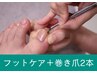 【巻き爪】超本格足爪フットケア＋巻き爪2本 110分¥18000→¥15000