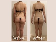 レモン(Lemon)/ビフォーアフター