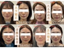 ビーキュート 姫路店(BE-CUTE)の雰囲気(それぞれのお悩みを改善し、美しい小顔に導きます☆韓国式コルギ)