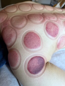 ハナハナ(Hana Hana)/【はなはな】悪いところを可視化