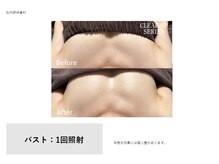 トータルクリア(TOTAL CLEAR)/光バストモード