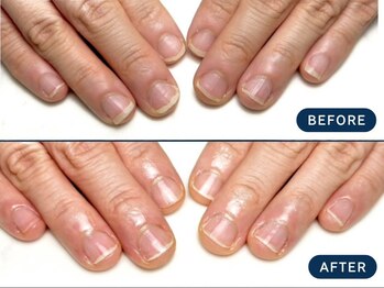 マニネイル 高の原店(mani nail)/ネイルケア