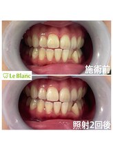 ルブラン 奈良店(Le Blanc)/一大イベントに欠かせない
