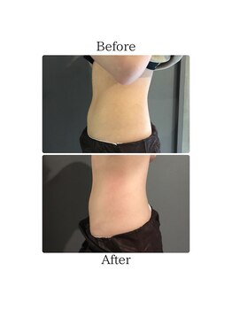 ウナ デ リンゴル 恵比寿店(UNA de Ringol)/今だけボディ痩身60分打ち放題