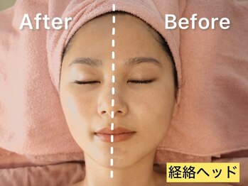 アールエイチビー 藤沢店(RHB)/経絡小顔ヘッドマッサージ