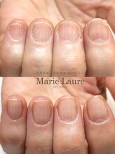マリーロール 淀屋橋本店(Marie Laure)/自爪育成/深爪矯正/ネイルケア