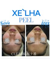 クリア 麻布十番(CLEAR)/第四世代　セラピール　ララ卒業