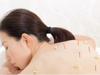 はにかむの写真/【健康な体に美は宿る】肩こり腰痛はもちろん、自律神経の乱れによる頭痛など様々な不調を根本から改善へ◎