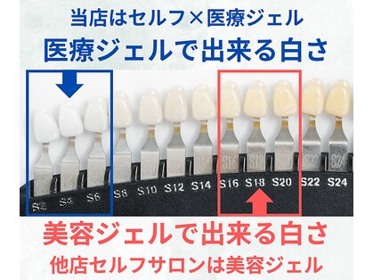 スマイルホワイト 赤羽店の写真