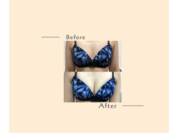 オベリオ(OBERIO)/