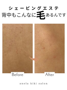 アネラ キキ サロン(anela kiki salon)/シェービングエステ