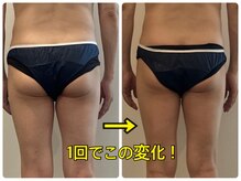 プリンセス ボディ/エステと整体効果が両方わかる！