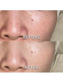 マーブルスタイル(MARBLE STYLE)/【BeforeAfter】フルコース