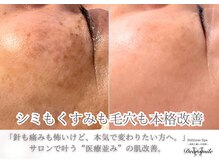 ディアスマイル(Dear.smile)