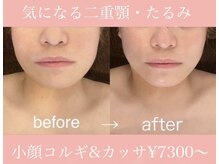 プール エドボリ(POOL EDOBORI)