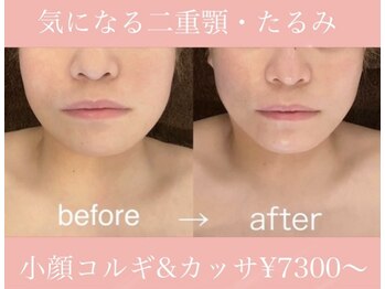 プール エドボリ(POOL EDOBORI)