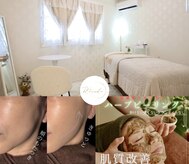 リアンダ(Rianda)