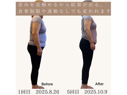 リマ(LIMA)の写真