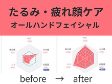 アールフェイシャル 郡山店(Rr.FACIAL)