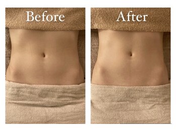 フルールドソレイユ(Fleur de Soleil)/これから妊活を頑張りたい方へ