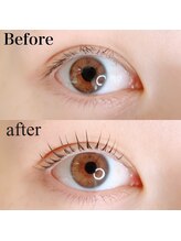 アンルル(EYE+anruru)/L3リフト