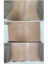 モンクラッシー(Mon classy)/