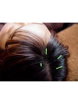 ヘッドスパで癒されたい