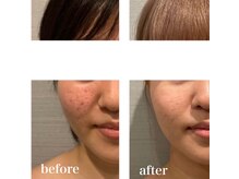 ハリーベージュ(Hariy Beige)/HariyBeige麻布十番