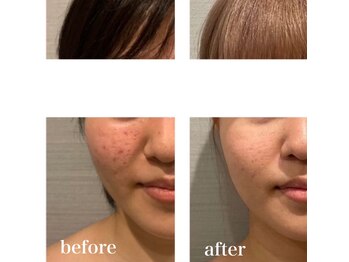 ハリーベージュ(Hariy Beige)/HariyBeige麻布十番