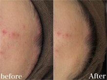 プライベートサロン ラウレア(Laule'a)/