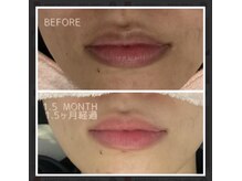 ファースト(1st)/ローマピンク【唇・リップ】