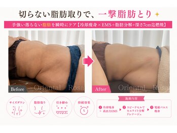 オリエンタルローザ 表参道(Oriental Rosa)の写真/エステ最上位痩身マイクロ波2.45GHzNEO WAVES-blanche-で即時引締め☆徹底贅肉液状化★広範囲施術が可能！