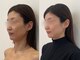 リーズリアン(Rises Lien)の写真/ホウレイ線、フェイスラインのぼやけ、老け見えに悩んでいませんか？鏡を見て落ち込む日を卒業しませんか？