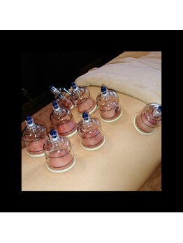 ナコズ エステティック(Nakos esthetic)/【人気】無料カッピング♪