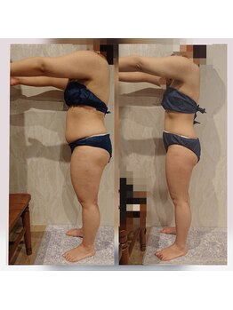 カルナボディ(Carna body.)/幼少期からお悩みの体型も改善☆